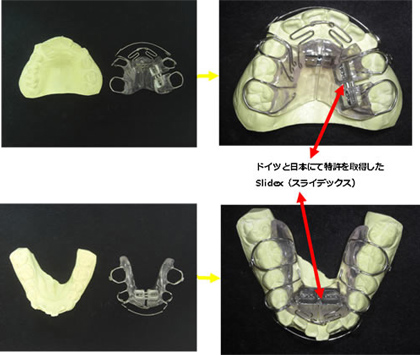 SH療法